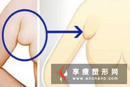 副乳有什么症状表现–安居客房产问答